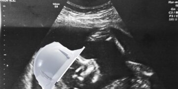 Alberta ultrasound meme